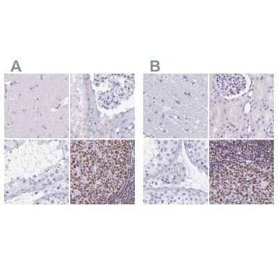 Immunohistochemistry-Paraffin: Ikaros/IKZF1 Antibody [NBP2-38241]