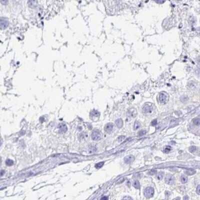 Immunohistochemistry-Paraffin: Ikaros/IKZF1 Antibody [NBP2-38241]