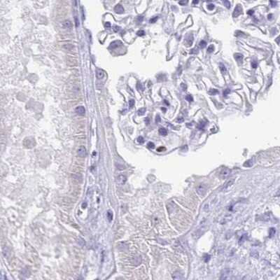 Immunohistochemistry-Paraffin: Ikaros/IKZF1 Antibody [NBP2-38241]
