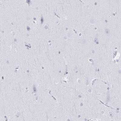 Immunohistochemistry-Paraffin: Ikaros/IKZF1 Antibody [NBP2-38242]