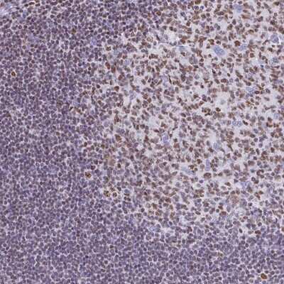 Immunohistochemistry-Paraffin: Ikaros/IKZF1 Antibody [NBP2-38242]