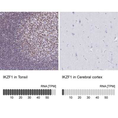 Immunohistochemistry-Paraffin: Ikaros/IKZF1 Antibody [NBP2-38242]