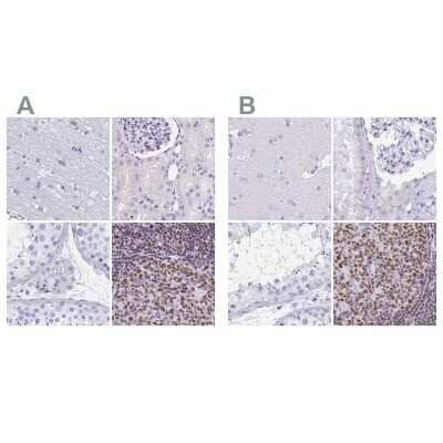 Immunohistochemistry-Paraffin: Ikaros/IKZF1 Antibody [NBP2-38242]