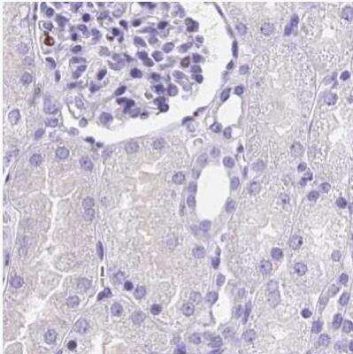 Immunohistochemistry-Paraffin: Ikaros/IKZF1 Antibody [NBP2-38242]