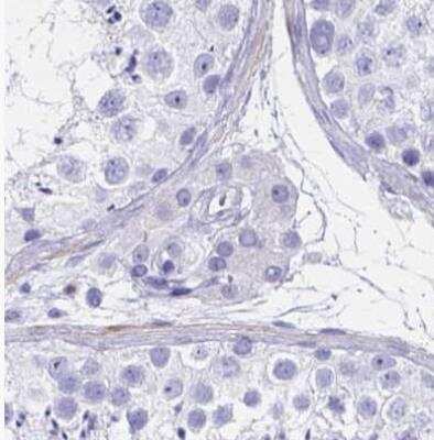 Immunohistochemistry-Paraffin: Ikaros/IKZF1 Antibody [NBP2-38242]