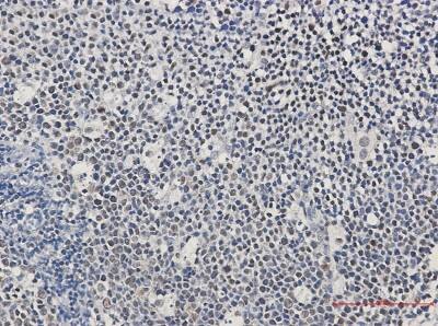 Immunohistochemistry-Paraffin: Ikaros/IKZF1 Antibody (S08-5E4) [NBP3-19660]