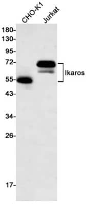 Western Blot: Ikaros/IKZF1 Antibody (S08-5E4) [NBP3-19660]