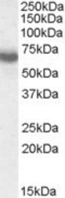 Western Blot: Ikaros/IKZF1 Antibody [NBP1-00125]