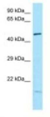 Western Blot: Ikaros/IKZF1 Antibody [NBP1-98314]