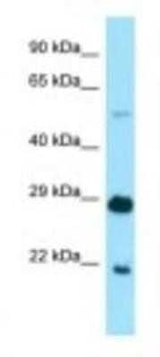 Western Blot: Ikaros/IKZF1 Antibody [NBP1-98565]