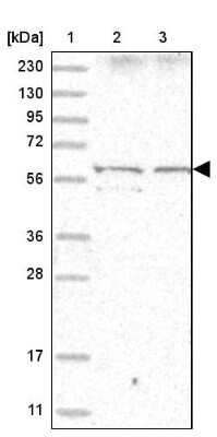 Western Blot: Ikaros/IKZF1 Antibody [NBP2-38242]