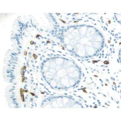 Immunohistochemistry: ImmPRESS(TM) Excel Amplified anti-Mouse IgG HRP polymer Staining Kit (Colorimetric) [MP-7602-NB]