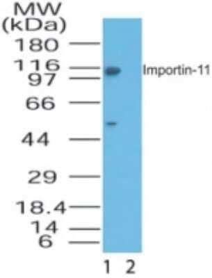 Western Blot: Importin 11 AntibodyAzide Free [NBP2-33209]