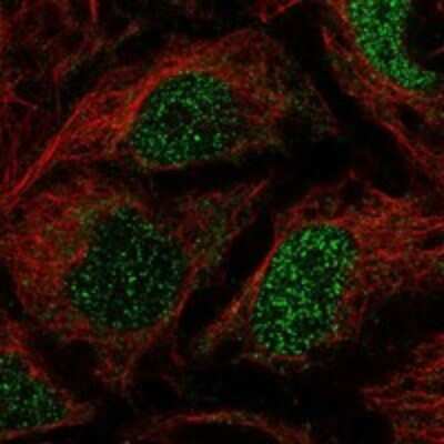 Immunocytochemistry/ Immunofluorescence: Importin 11 Antibody [NBP3-17196]