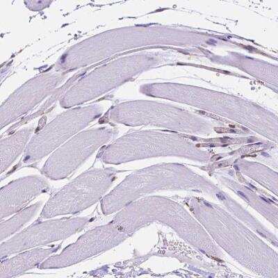 Immunohistochemistry-Paraffin: Importin 11 Antibody [NBP2-49505]