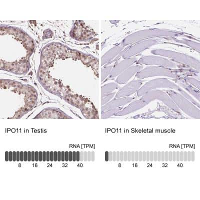 Immunohistochemistry-Paraffin: Importin 11 Antibody [NBP2-49505]