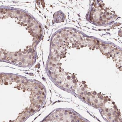 Immunohistochemistry-Paraffin: Importin 11 Antibody [NBP2-49505]