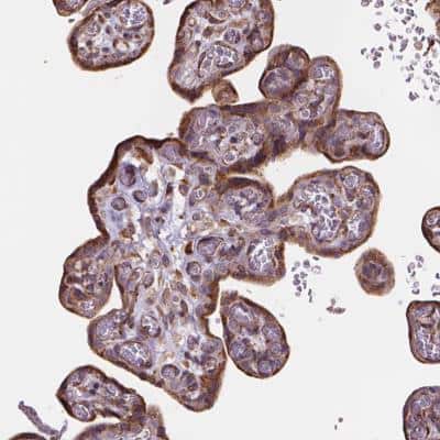 Immunohistochemistry-Paraffin: Importin 11 Antibody [NBP2-49505]