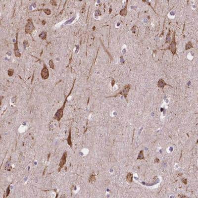Immunohistochemistry-Paraffin: Importin 11 Antibody [NBP2-49505]