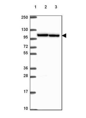 Western Blot: Importin 11 Antibody [NBP2-49505]