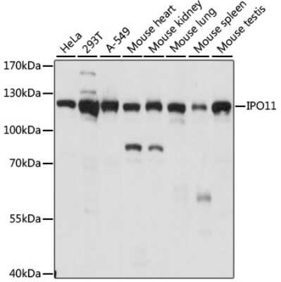 Western Blot: Importin 11 AntibodyAzide and BSA Free [NBP3-03801]