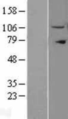 Western Blot: Importin 11 Overexpression Lysate [NBL1-12014]