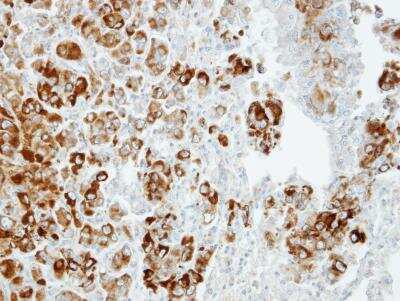 Immunohistochemistry-Paraffin: Importin-13 Antibody [NBP1-31508]