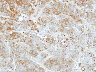 Immunohistochemistry-Paraffin: Importin-13 Antibody [NBP2-14994]