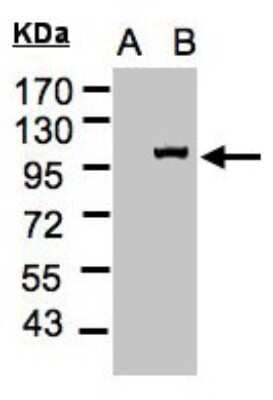 Western Blot: Importin-13 Antibody [NBP1-31508]