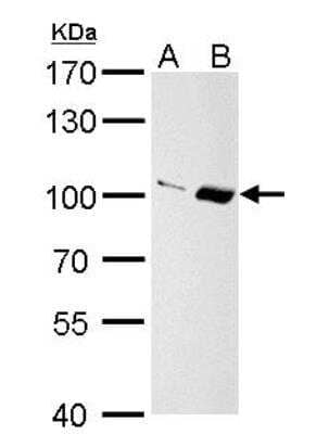 Western Blot: Importin-13 Antibody [NBP1-31508]