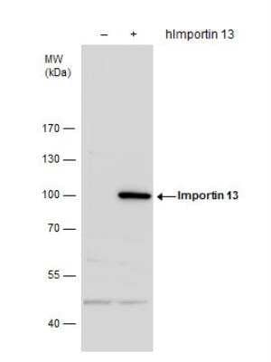 Western Blot: Importin-13 Antibody [NBP2-14994]