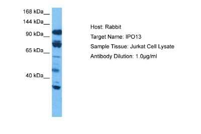 Western Blot: Importin-13 Antibody [NBP2-86677]