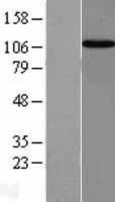 Western Blot: Importin-13 Overexpression Lysate [NBL1-12015]