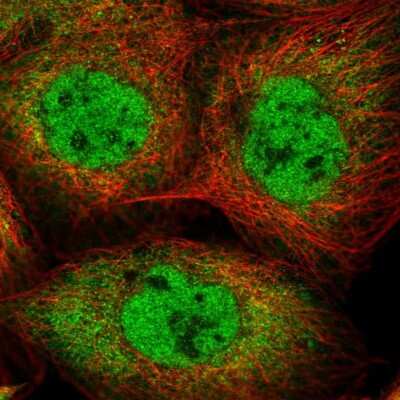 Immunocytochemistry/ Immunofluorescence: Importin-7 Antibody [NBP2-56778]