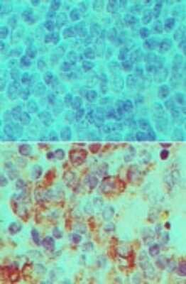 Immunohistochemistry-Paraffin: Importin-7 Antibody [NBP2-27150]