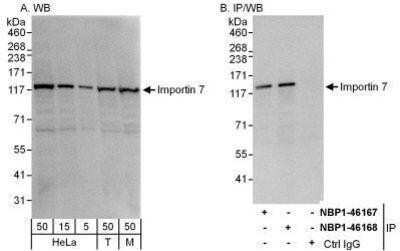 Western Blot: Importin-7 Antibody [NBP1-46168]