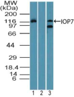 Western Blot: Importin-7 Antibody [NBP2-27150]