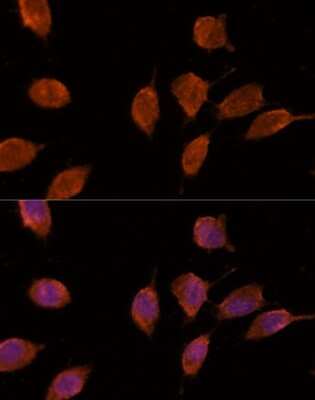 Immunocytochemistry/ Immunofluorescence: Importin-8 Antibody - Azide and BSA Free [NBP3-03821]