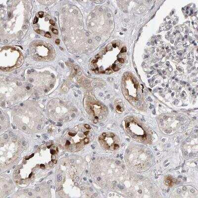 Immunohistochemistry-Paraffin: Importin-8 Antibody [NBP1-87878]