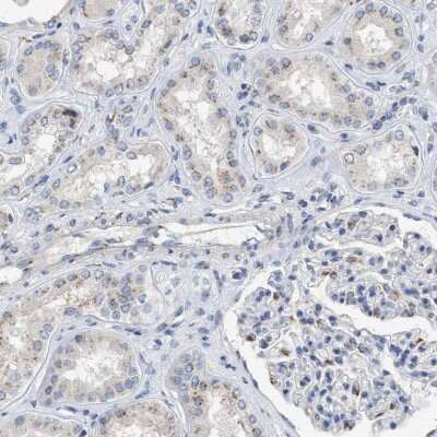 Immunohistochemistry-Paraffin: Importin-8 Antibody [NBP1-87879]