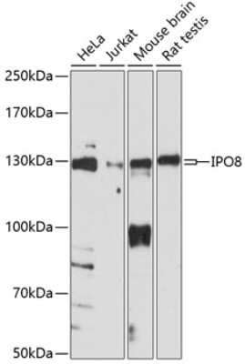 Western Blot: Importin-8 AntibodyAzide and BSA Free [NBP3-03821]