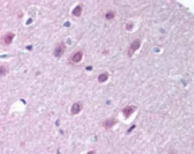 Immunohistochemistry-Paraffin: Importin-9 Antibody [NB100-56489]