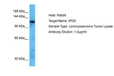 Western Blot: Importin-9 Antibody [NBP2-86679]