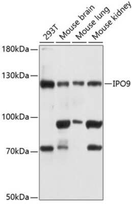 Western Blot: Importin-9 AntibodyAzide and BSA Free [NBP3-03818]