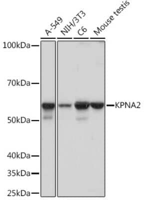 Western Blot: Importin alpha 2/KPNA2 Antibody (9T3V8) [NBP3-16530]