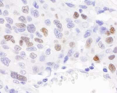 Immunohistochemistry: Importin alpha 2/KPNA2 Antibody [NB100-79807]