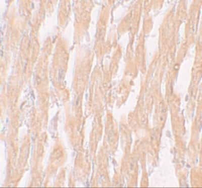 Immunohistochemistry: Importin alpha 2/KPNA2 Antibody - BSA Free [NBP1-76298]