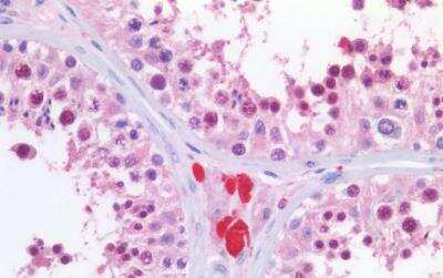 Immunohistochemistry-Paraffin: Importin alpha 2/KPNA2 Antibody [NB100-1371]