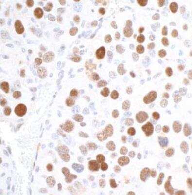 Immunohistochemistry-Paraffin: Importin alpha 2/KPNA2 Antibody [NB100-79808]
