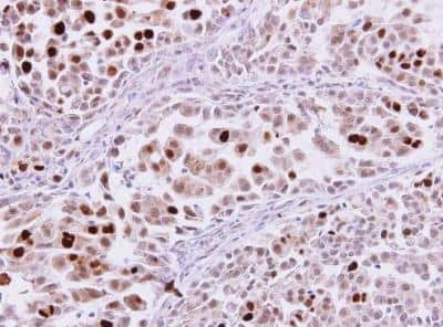 Immunohistochemistry-Paraffin: Importin alpha 2/KPNA2 Antibody [NBP1-31098]